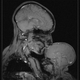 Illustration for article titled MRI of Mother and Child Shows Love Through The Eyes of Science